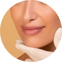 rhinoplasty