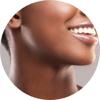 buccal fat pad removal
