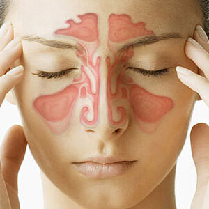 sinus disease